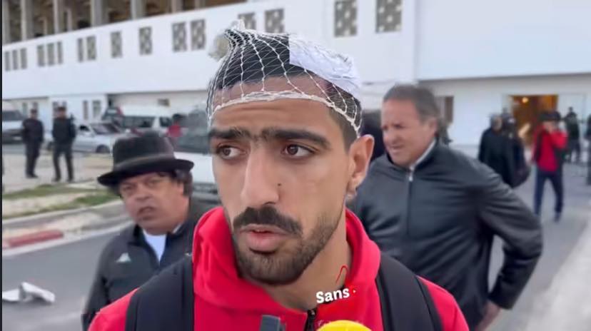 هل تظاهر محمد أمين بن حميدة بالإصابة في مباراة النجم ؟